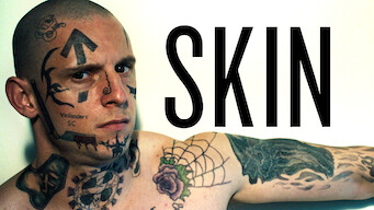 Skin